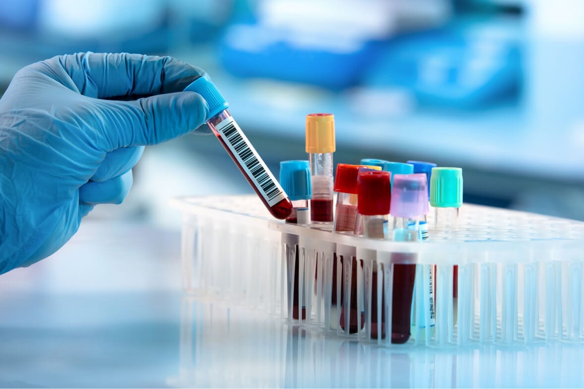 How Laboratory Tests Help Doctors Diagnose Disease - Health Screen ...